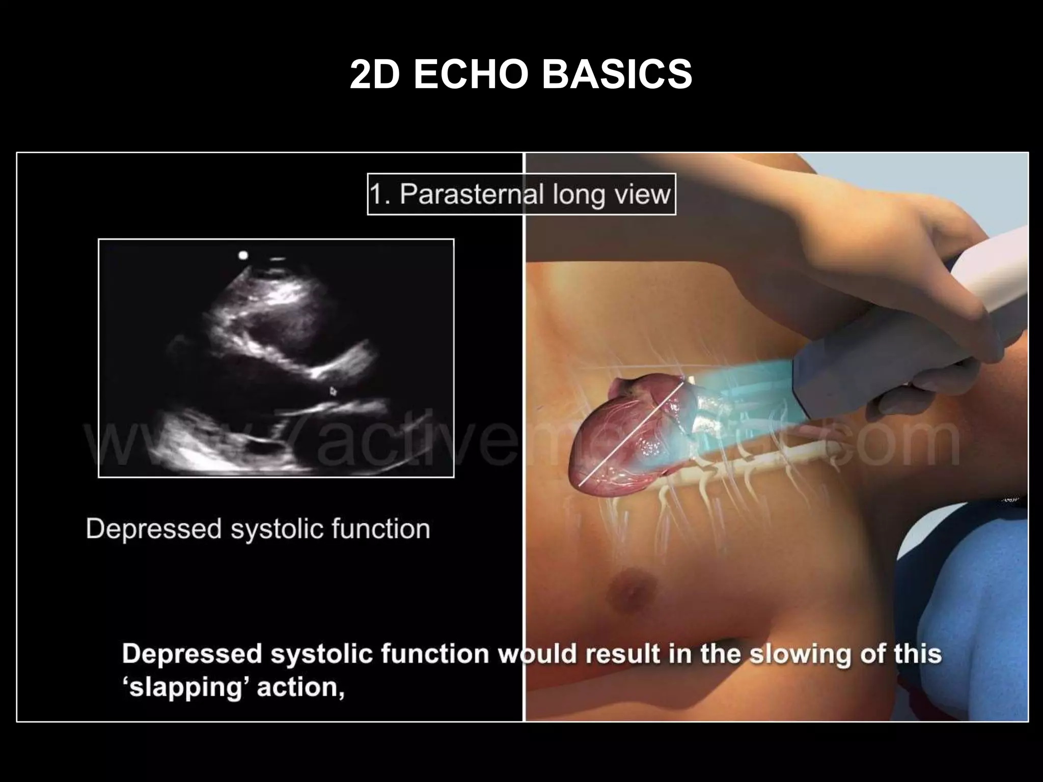 2D ECHO BASICS
 
