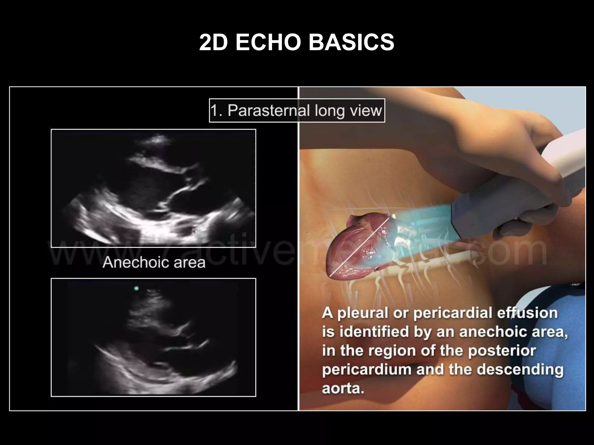 2D ECHO BASICS
 