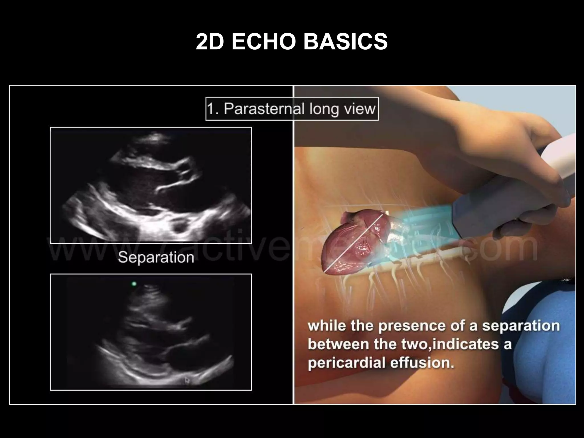 2D ECHO BASICS
 