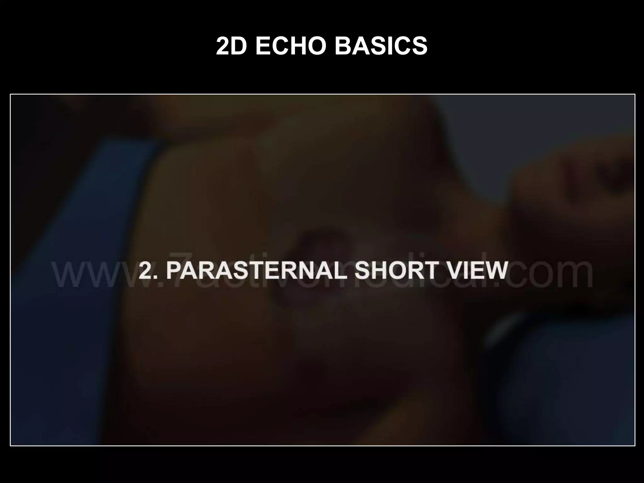 2D ECHO BASICS
 