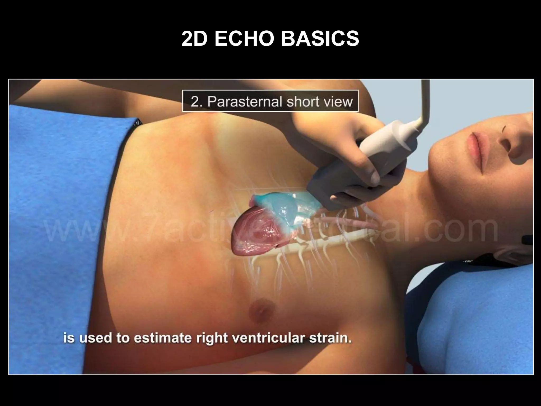 2D ECHO BASICS
 