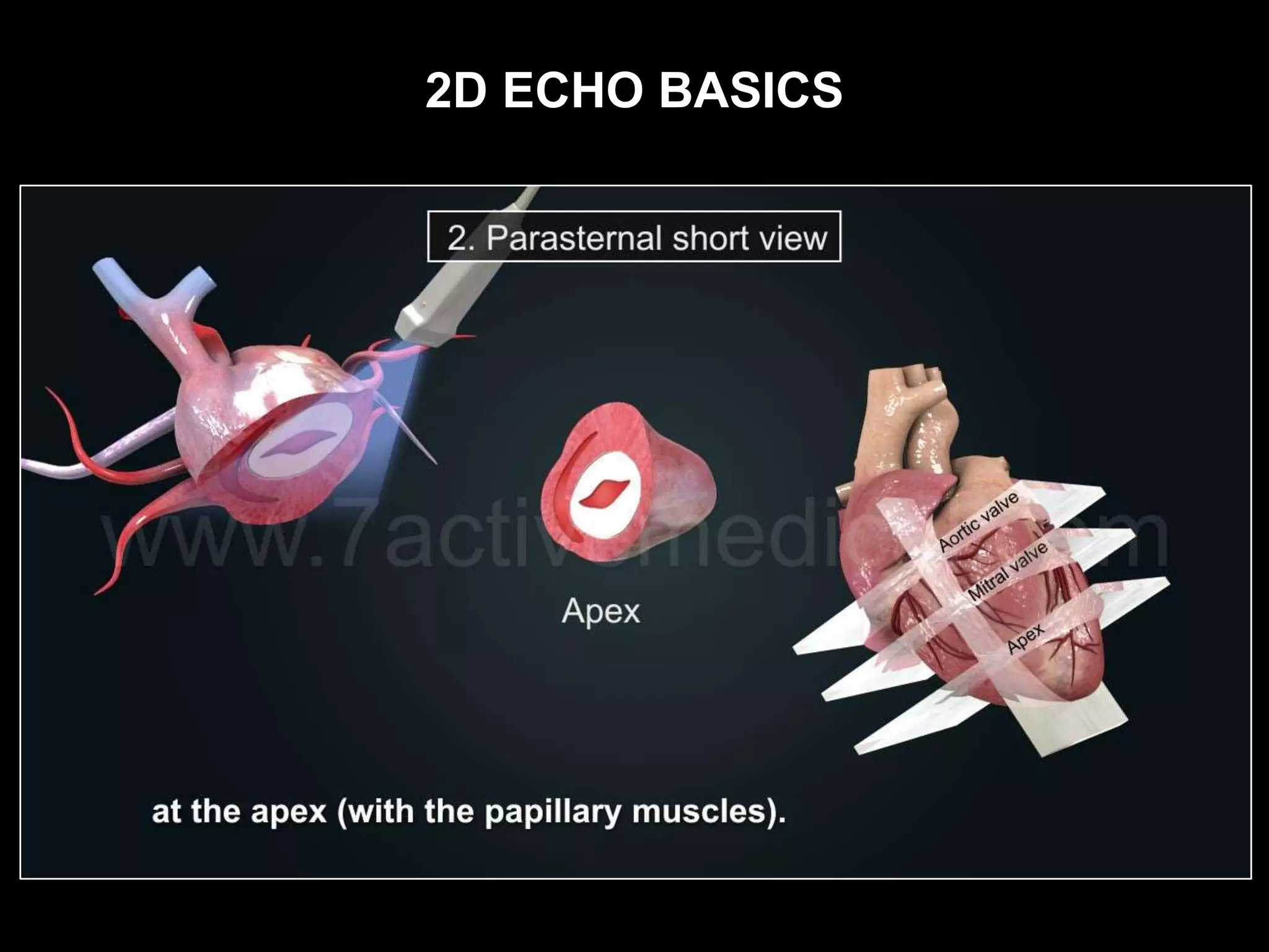 2D ECHO BASICS
 