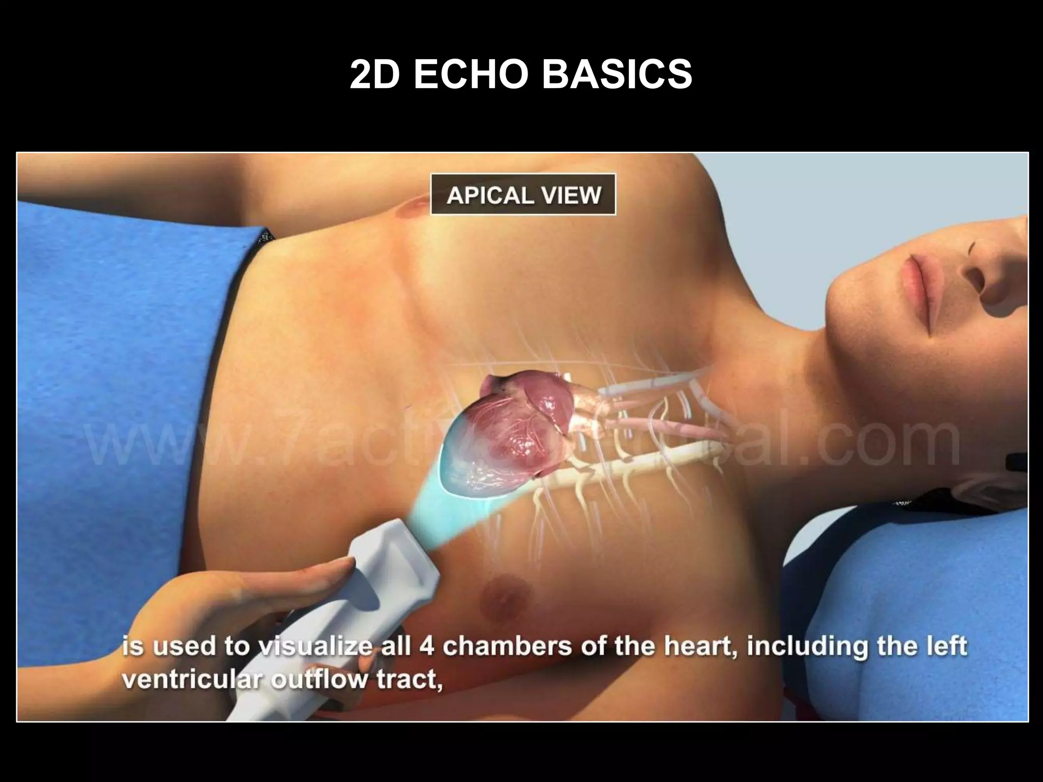 2D ECHO BASICS
 