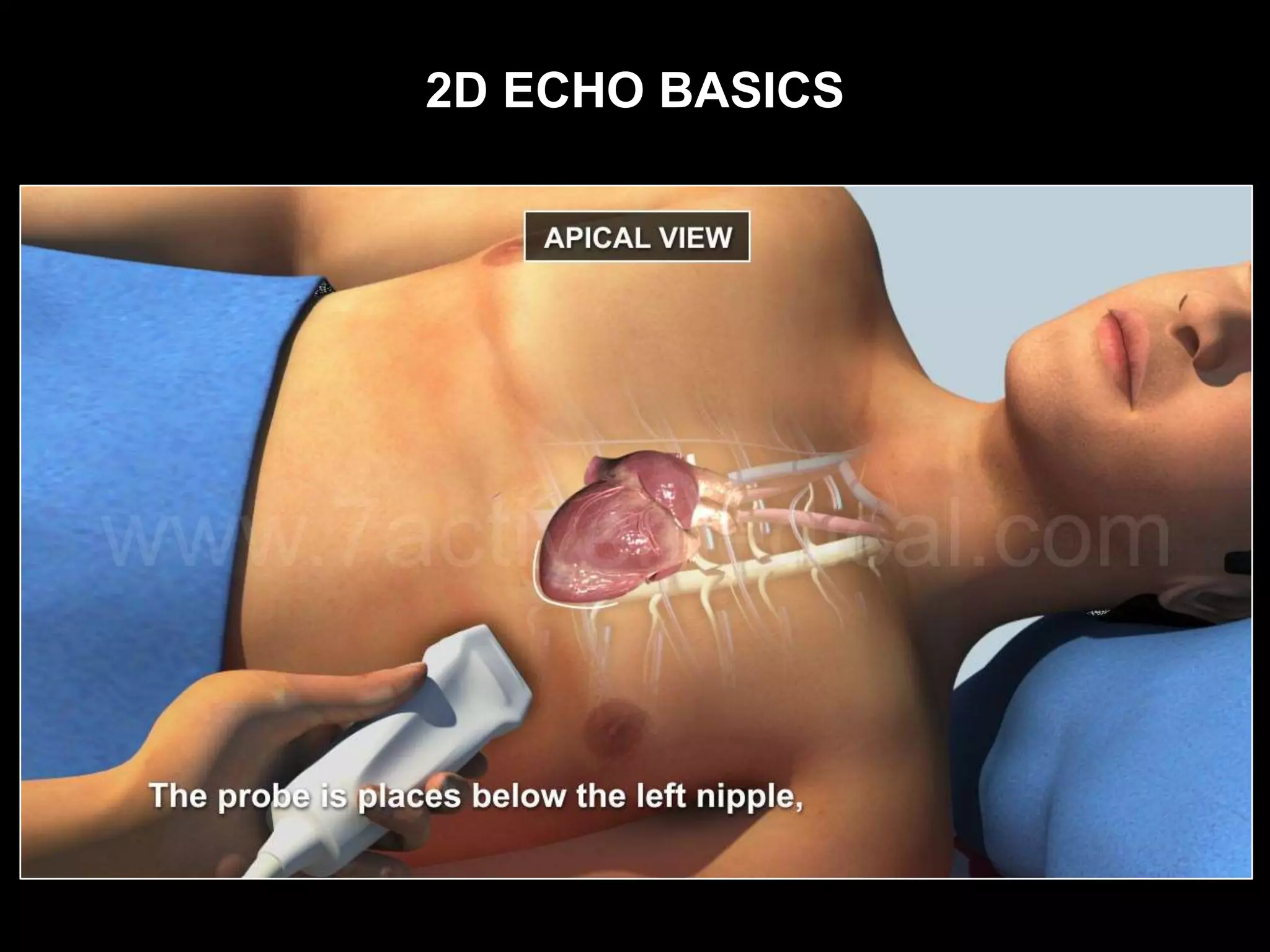 2D ECHO BASICS
 