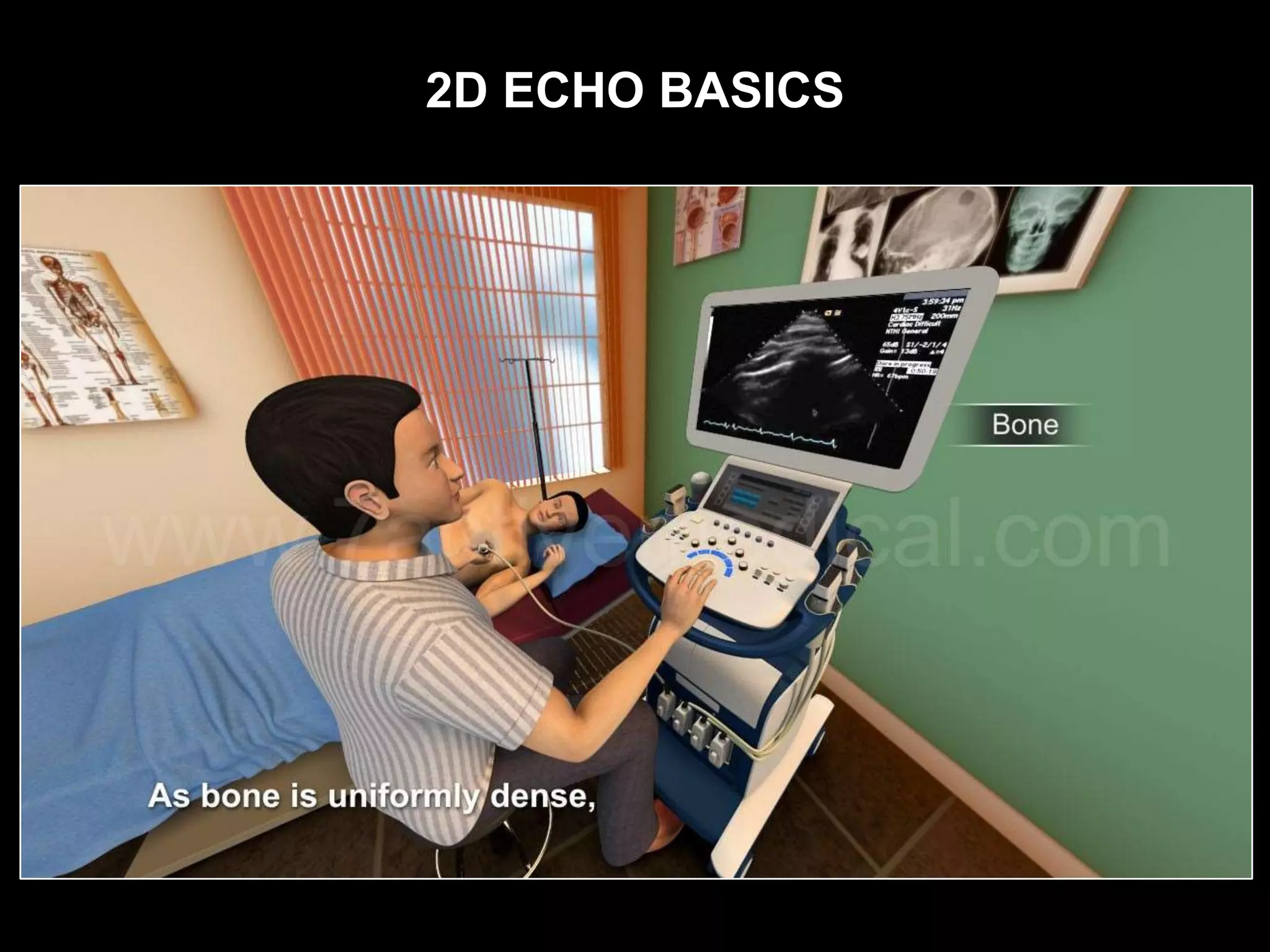2D ECHO BASICS
 