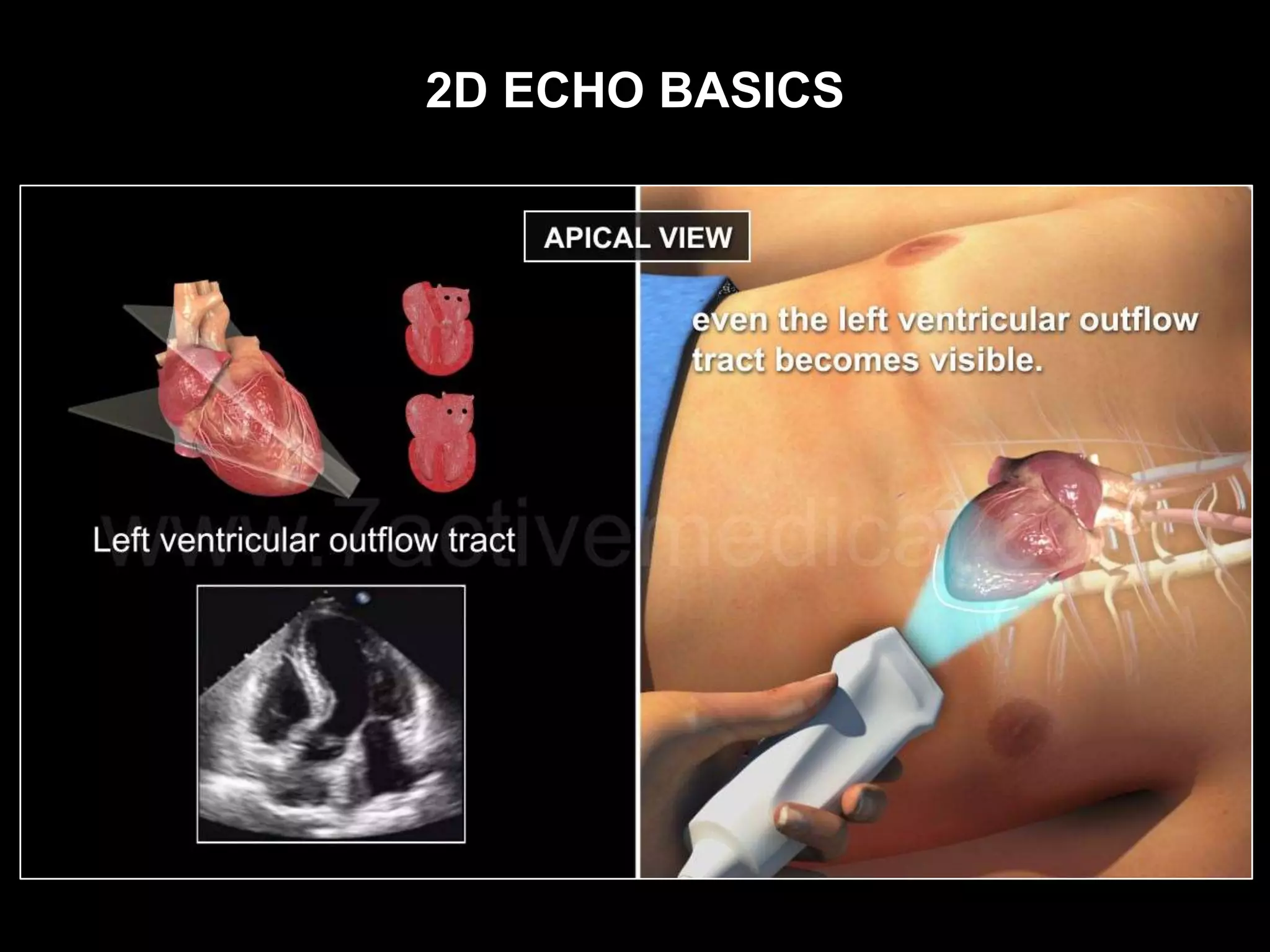 2D ECHO BASICS
 