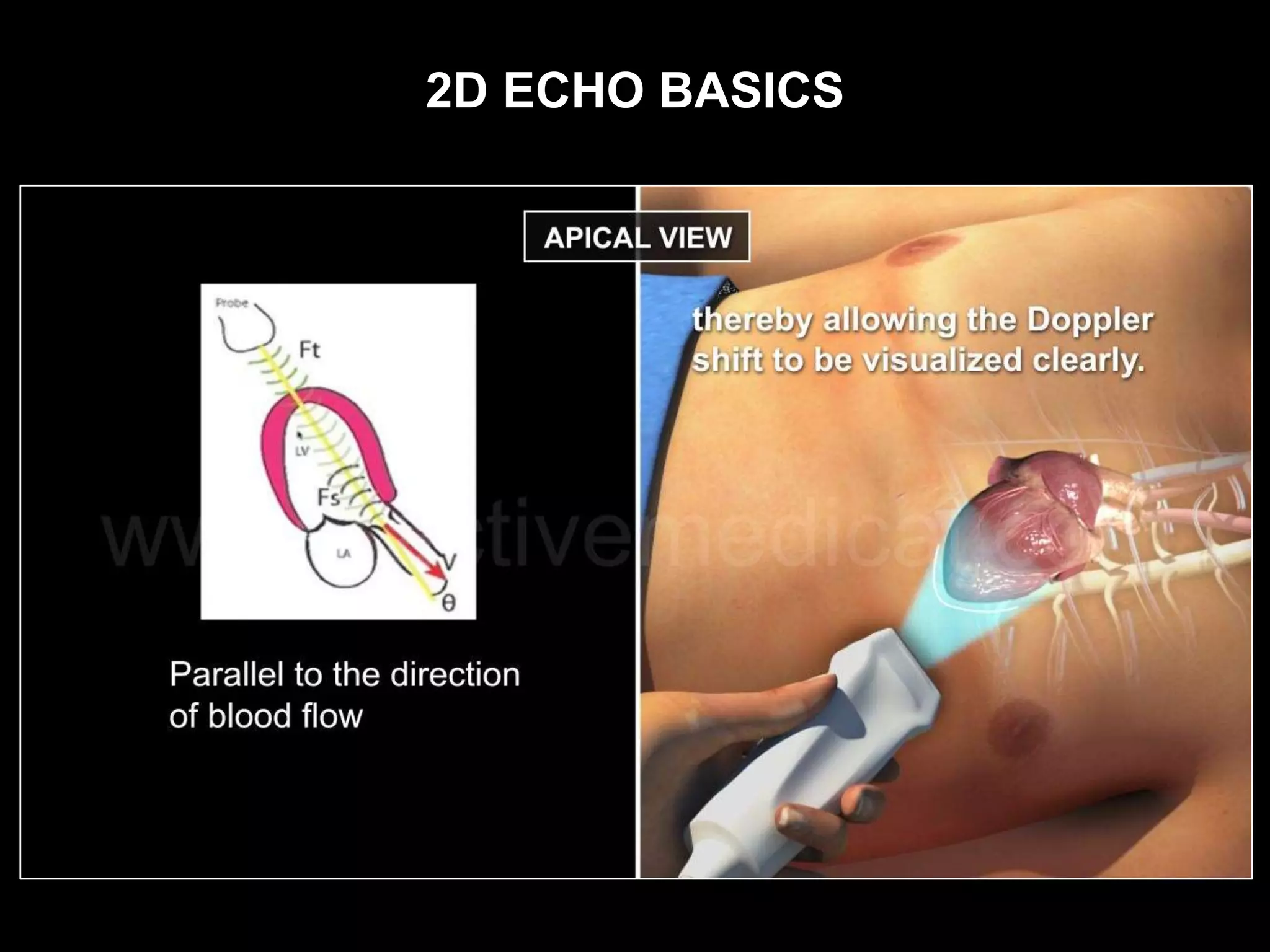 2D ECHO BASICS
 