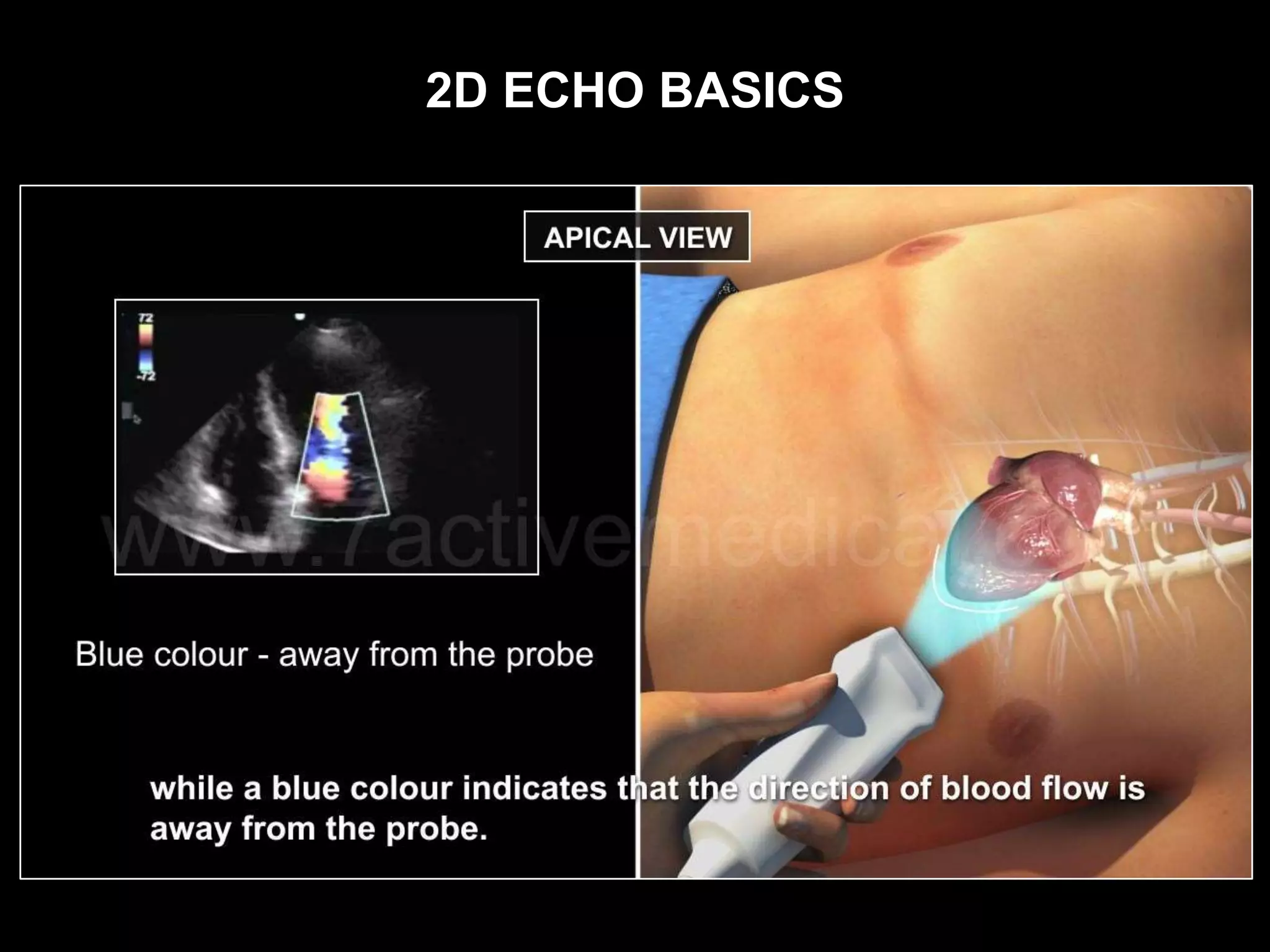 2D ECHO BASICS
 