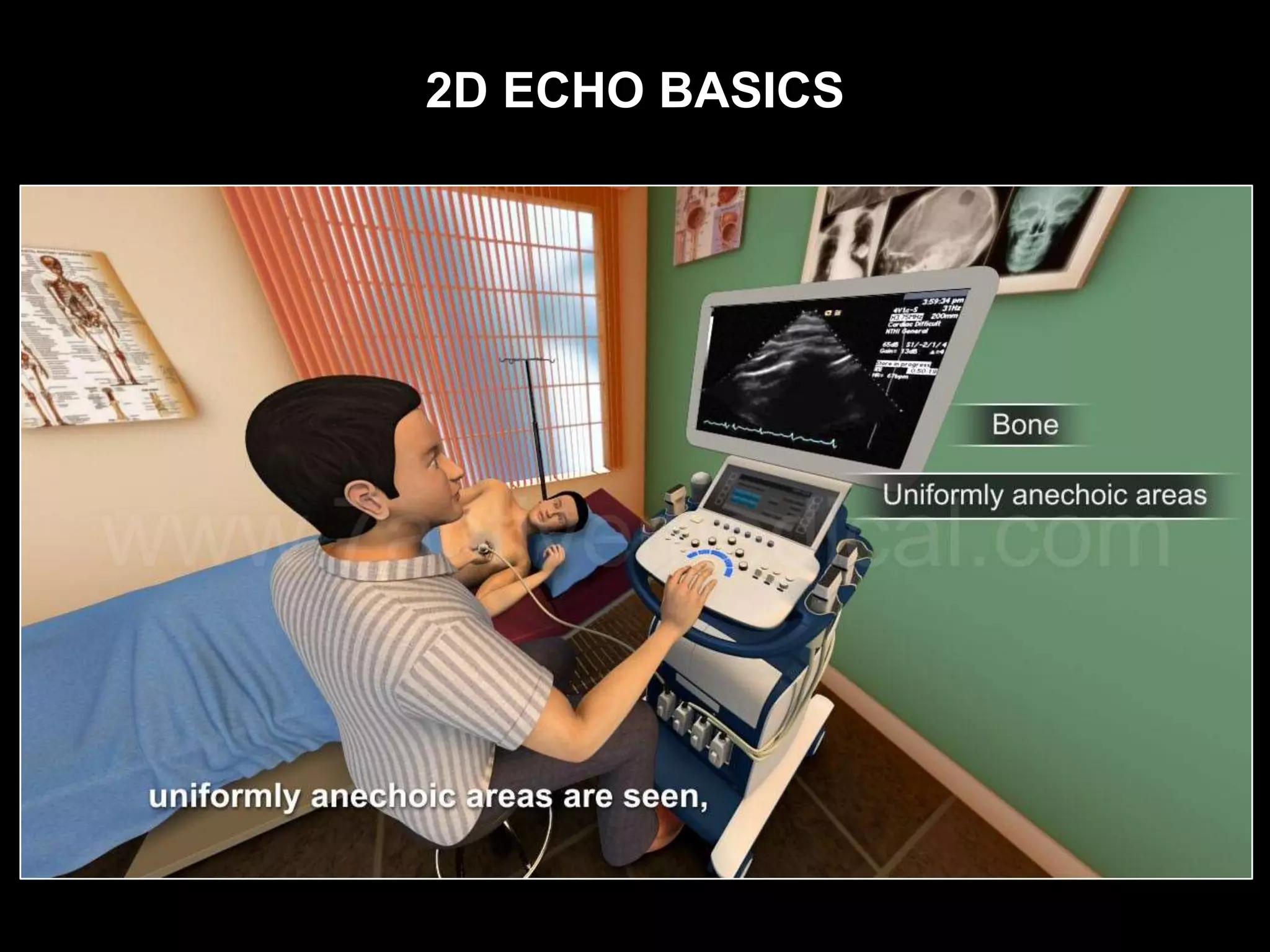 2D ECHO BASICS
 