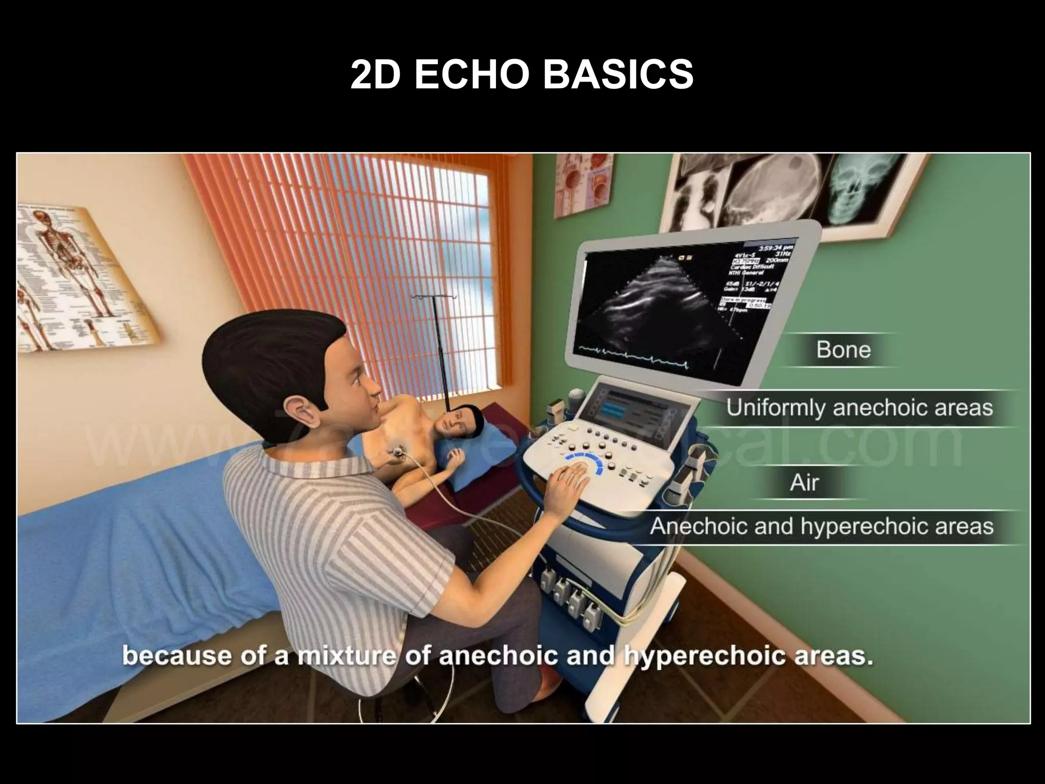 2D ECHO BASICS
 