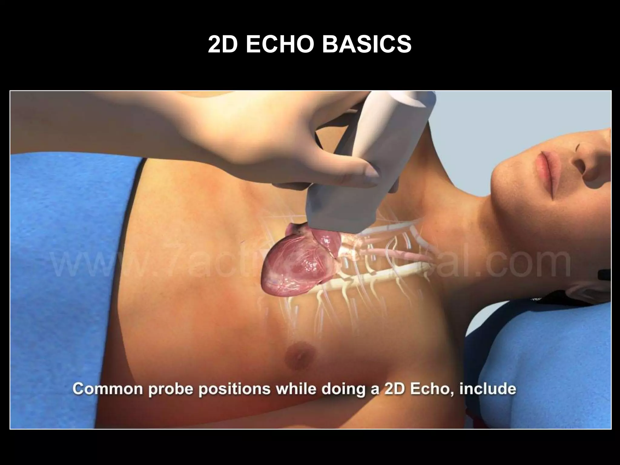 2D ECHO BASICS
 