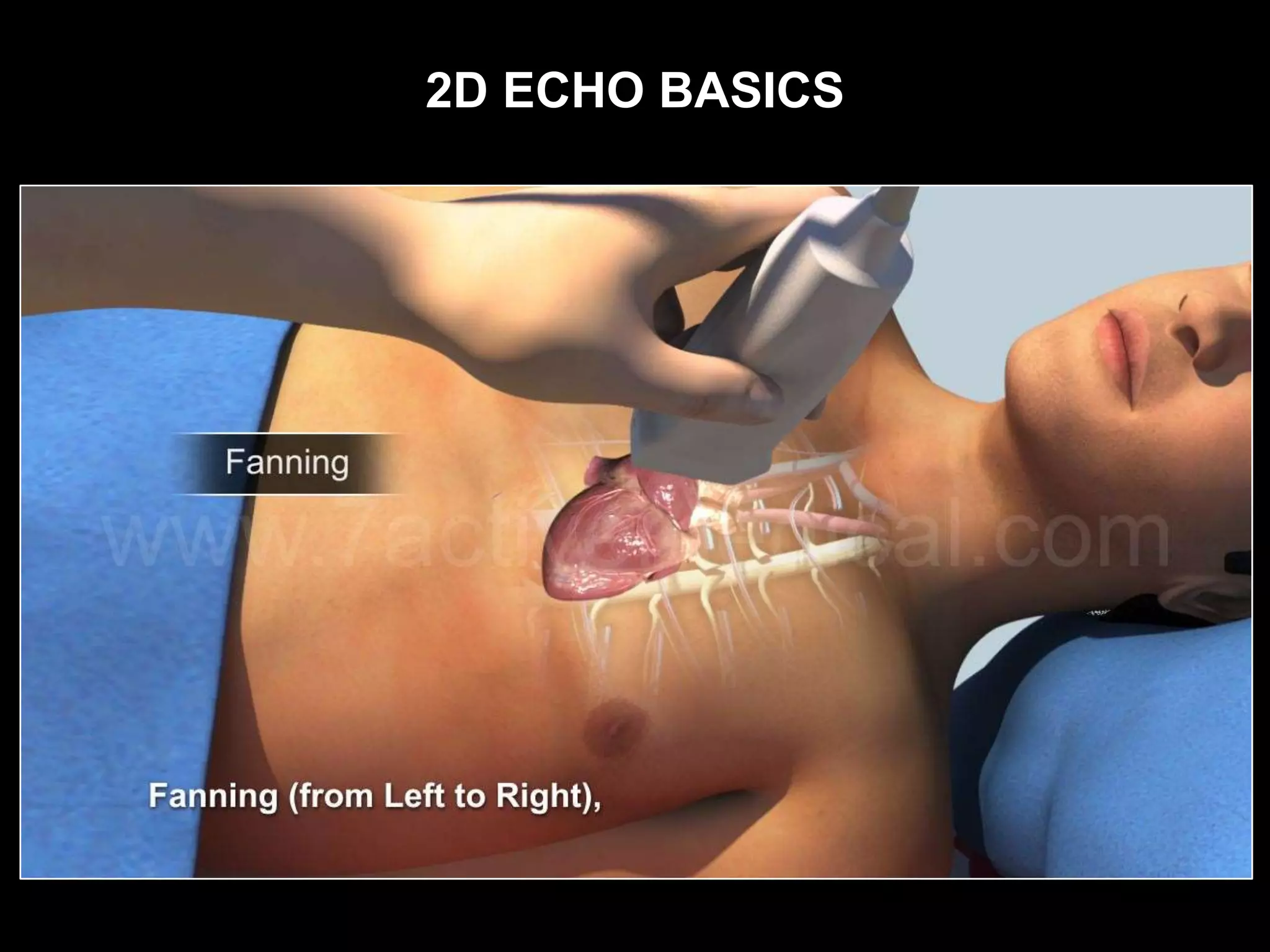 2D ECHO BASICS
 