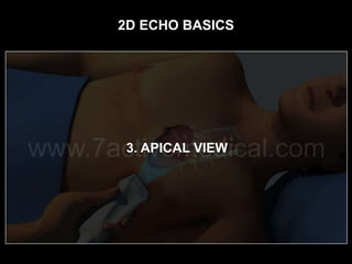 2d Echo Basics | PPTX
