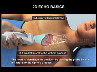 2d Echo Basics | PPTX
