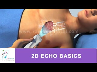 2D ECHO BASICS
 
