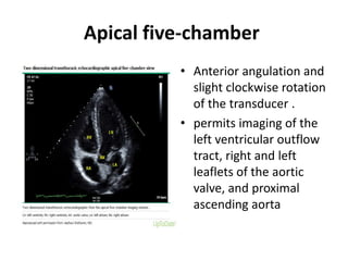 Apical five-chamber
• Anterior angulation and
slight clockwise rotation
of the transducer .
• permits imaging of the
left ventricular outflow
tract, right and left
leaflets of the aortic
valve, and proximal
ascending aorta
 