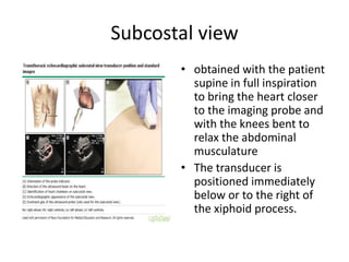 Subcostal view
• obtained with the patient
supine in full inspiration
to bring the heart closer
to the imaging probe and
with the knees bent to
relax the abdominal
musculature
• The transducer is
positioned immediately
below or to the right of
the xiphoid process.
 