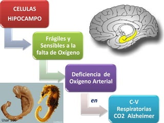 CELULAS
HIPOCAMPO
Frágiles y
Sensibles a la
falta de Oxígeno
Deficiencia de
Oxígeno Arterial
C-V
Respiratorias
CO2 Alzheimer11
Usar 160
en
 