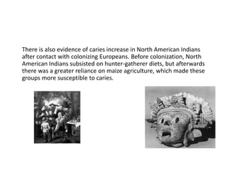 There is also evidence of caries increase in North American Indians
after contact with colonizing Europeans. Before colonization, North
American Indians subsisted on hunter-gatherer diets, but afterwards
there was a greater reliance on maize agriculture, which made these
groups more susceptible to caries.
 