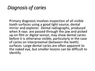 Diagnosis of caries
Primary diagnosis involves inspection of all visible
tooth surfaces using a good light source, dental
mirror and explorer. Dental radiographs, produced
when X-rays are passed through the jaw and picked
up on film or digital sensor, may show dental caries
before it is otherwise visible, particularly in the case
of caries on interproximal (between the teeth)
surfaces. Large dental caries are often apparent to
the naked eye, but smaller lesions can be difficult to
identify.
 