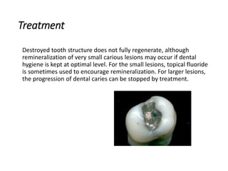Treatment
Destroyed tooth structure does not fully regenerate, although
remineralization of very small carious lesions may occur if dental
hygiene is kept at optimal level. For the small lesions, topical fluoride
is sometimes used to encourage remineralization. For larger lesions,
the progression of dental caries can be stopped by treatment.
 