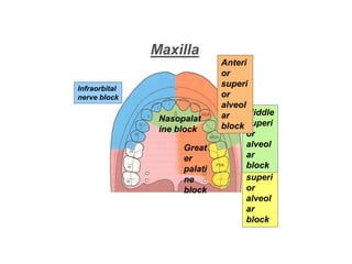 Maxilla
Infraorbital
nerve block
Nasopalat
ine block
Great
er
palati
ne
block
Poster
ior
superi
or
alveol
ar
block
Middle
superi
or
alveol
ar
block
Anteri
or
superi
or
alveol
ar
block
 