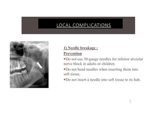 1) Needle breakage :
Prevention
Do not use 30-gauge needles for inferior alveolar
nerve block in adults or children.
Do not bend needles when inserting them into
soft tissue.
Do not insert a needle into soft tissue to its hub.
LOCAL COMPLICATIONS
6
7
 