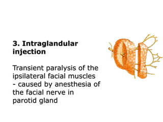 3. Intraglandular
injection
Transient paralysis of the
ipsilateral facial muscles
- caused by anesthesia of
the facial nerve in
parotid gland
 