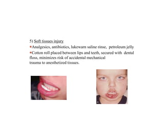 5) Soft tissues injury
Analgesics, antibiotics, lukewarn saline rinse, petroleum jelly
Cotton roll placed between lips and teeth, secured with dental
floss, minimizes risk of accidental mechanical
trauma to anesthetized tissues.
 