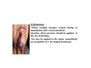 6) Hematoma :
When swelling becomes evident during or
immediately after a local anesthetic
injection, direct pressure should be applied to
the site of bleeding.
Ice may be applied to the region immediately
on recognition of a developing hematoma.
 