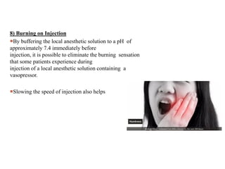 8) Burning on Injection
By buffering the local anesthetic solution to a pH of
approximately 7.4 immediately before
injection, it is possible to eliminate the burning sensation
that some patients experience during
injection of a local anesthetic solution containing a
vasopressor.
Slowing the speed of injection also helps
 