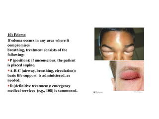 10) Edema
If edema occurs in any area where it
compromises
breathing, treatment consists of the
following:
P (position): if unconscious, the patient
is placed supine.
A-B-C (airway, breathing, circulation):
basic life support is administered, as
needed.
D (definitive treatment): emergency
medical services (e.g., 108) is summoned.
 