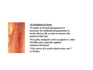 11) Sloughing of tissue
Usually, no formal management is
necessary for epithelial desquamation or
sterile abscess. Be certain to reassure the
patient of this fact.
For pain, analgesics such as aspirin or other
NSAIDs and a topically applied
ointment (Orabase)
The course of a sterile abscess may run 7
to 10 days
 