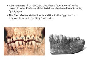 • A Sumerian text from 5000 BC describes a "tooth worm" as the
cause of caries. Evidence of this belief has also been found in India,
Egypt, Japan.
• The Greco-Roman civilization, in addition to the Egyptian, had
treatments for pain resulting from caries.
 