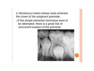 8. Deciduous molars whose roots embrace
the crown of the subjacent premolar.
If the simple extraction technique were to
be attempted, there is a great risk of
concurrent luxation of the premolar.
 