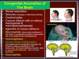 2) Development of cerebrum & cerebellum.Final-2016.pdf