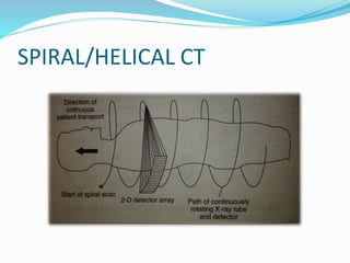 SPIRAL/HELICAL CT
 