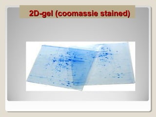 2D-gel (coomassie stained)2D-gel (coomassie stained)
 