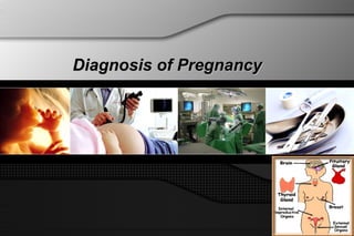 Diagnosis of PregnancyDiagnosis of Pregnancy
 