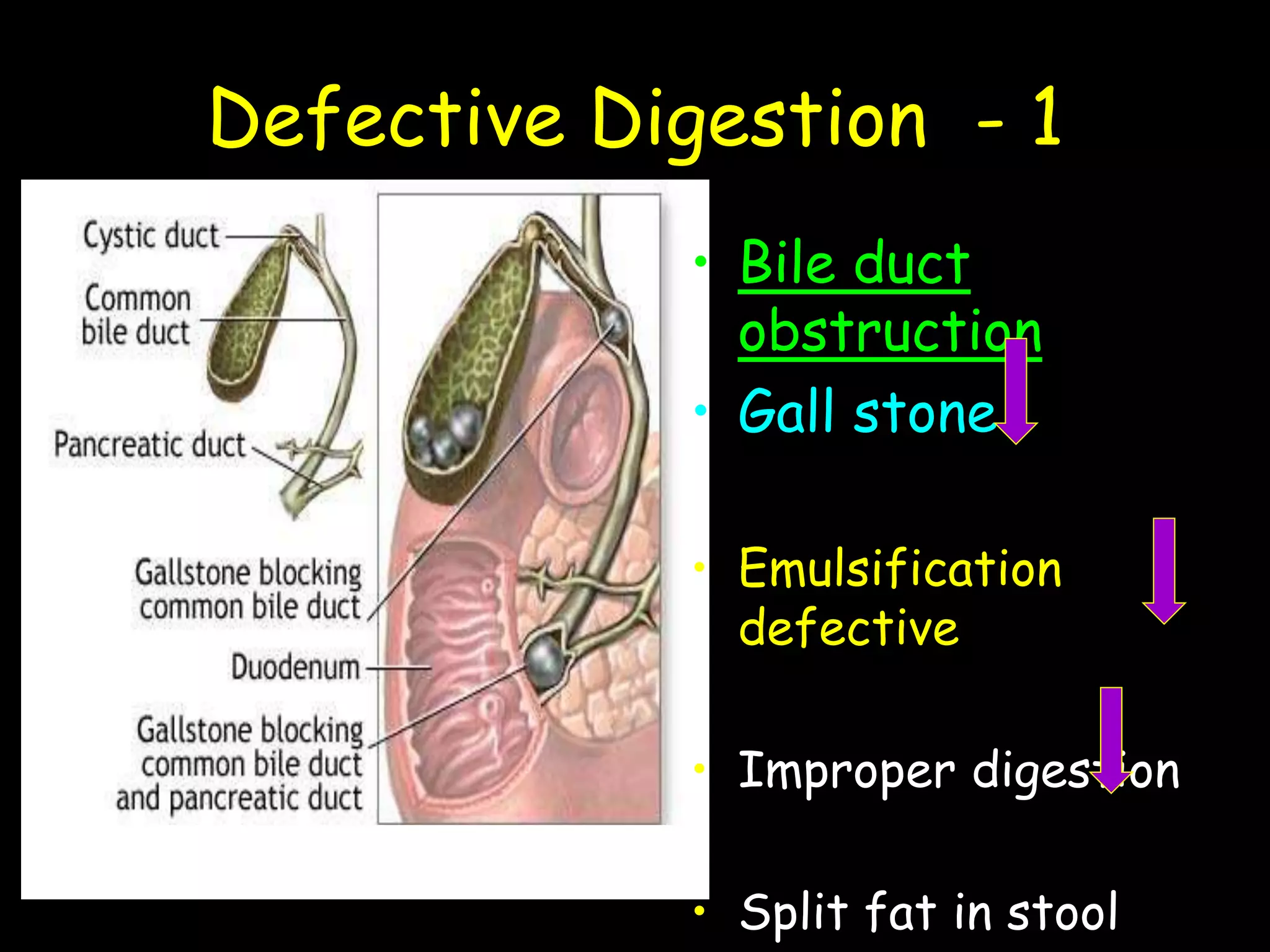 Defective Digestion - 1
• Bile duct
obstruction
• Gall stone
• Emulsification
defective
• Improper digestion
• Split fat in stool
 