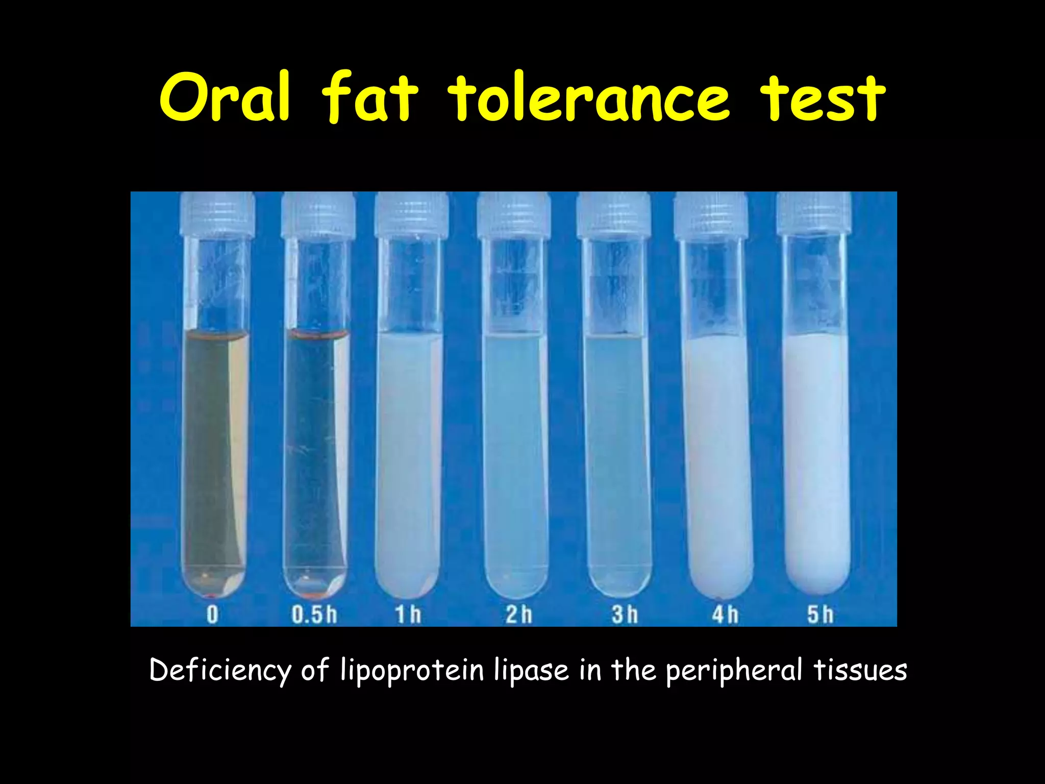 Oral fat tolerance test
Deficiency of lipoprotein lipase in the peripheral tissues
 