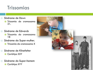 Trissomias
 Síndrome de Down
 Trissomia do cromossoma
21.
 Síndrome de Edwards
 Trissomia do cromossoma
18
 Síndrome da Super-mulher.
 Trissomia do cromossoma X
 Síndrome de Klinefelter
 Cariótipo XXY
 Síndrome do Super-homem
 Cariótipo XYY
 