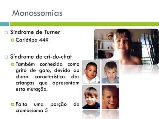 Monossomias
 Síndrome de Turner
 Cariótipo 44X
 Síndrome de cri-du-chat
 Também conhecido como
grito de gato, devido ao
choro característico das
crianças que apresentam
esta mutação.
 Falta uma porção do
cromossoma 5
 