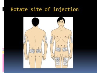 Multiple Injections Daily Site Rotation Management of Diabetes Mellitus | PDF