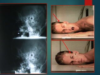 2do. PARCIAL 2DO. TEC. RAD. II.ppt