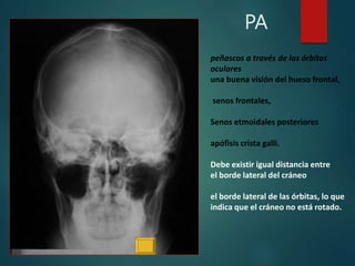 PA
peñascos a través de las órbitas
oculares
una buena visión del hueso frontal,
senos frontales,
Senos etmoidales posteriores
apófisis crista galli.
Debe existir igual distancia entre
el borde lateral del cráneo
el borde lateral de las órbitas, lo que
indica que el cráneo no está rotado.
 