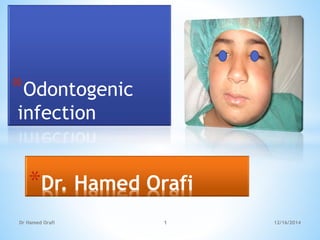 *Odontogenic
infection
12/16/2014Dr Hamed Orafi 1
*Dr. Hamed Orafi
 
