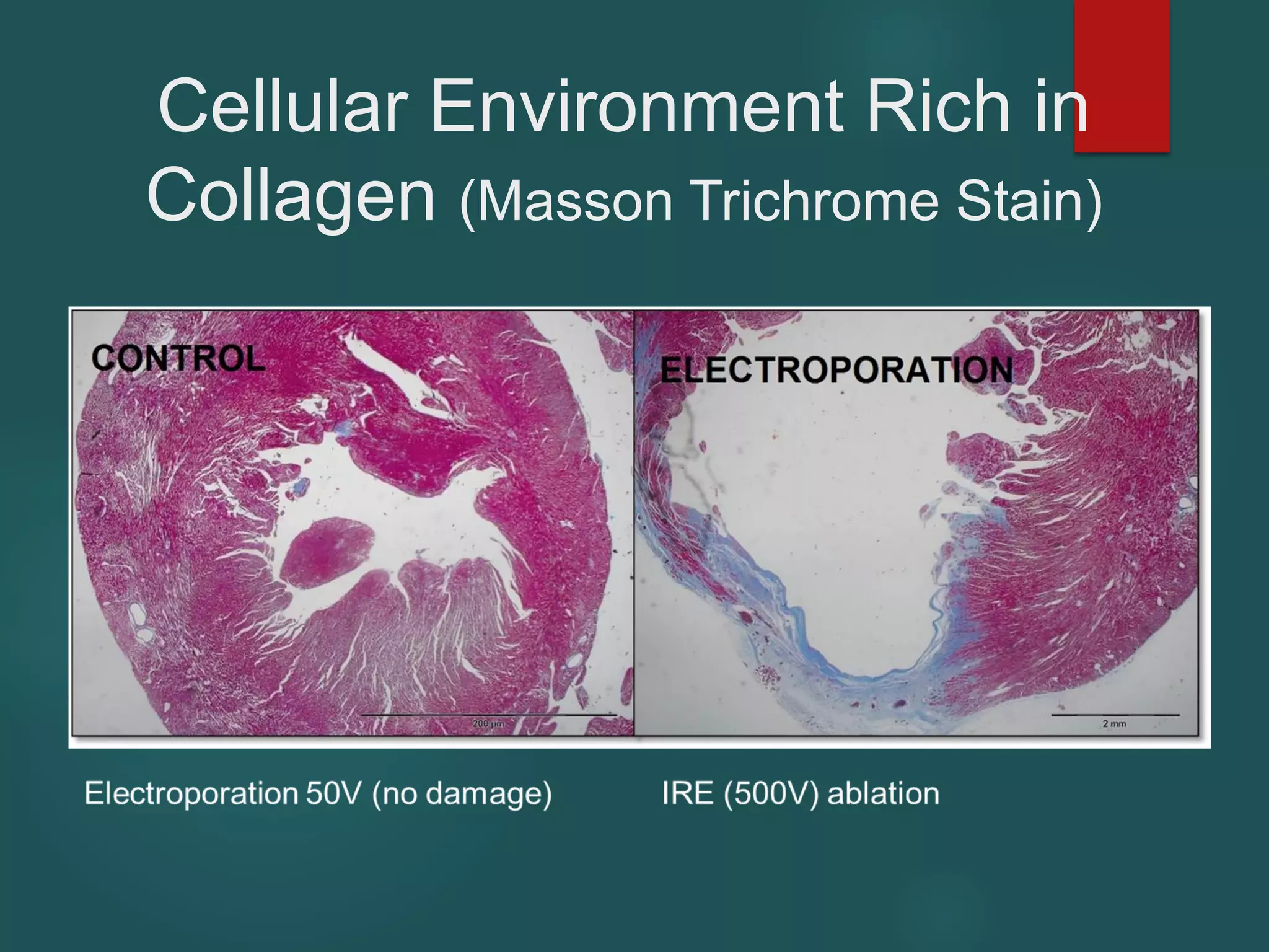 Cellular Environment Rich in
Collagen (Masson Trichrome Stain)
 