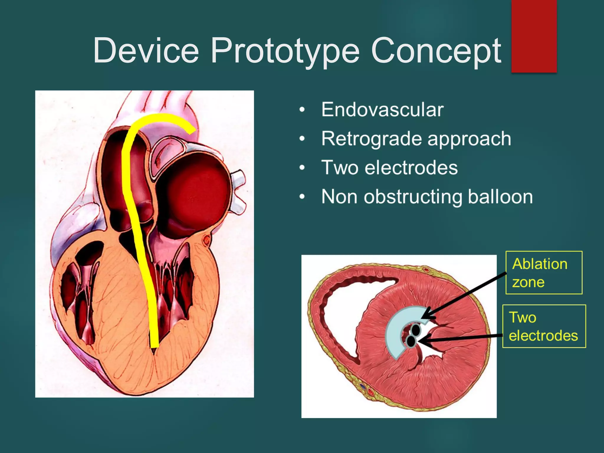 Device Prototype Concept
 