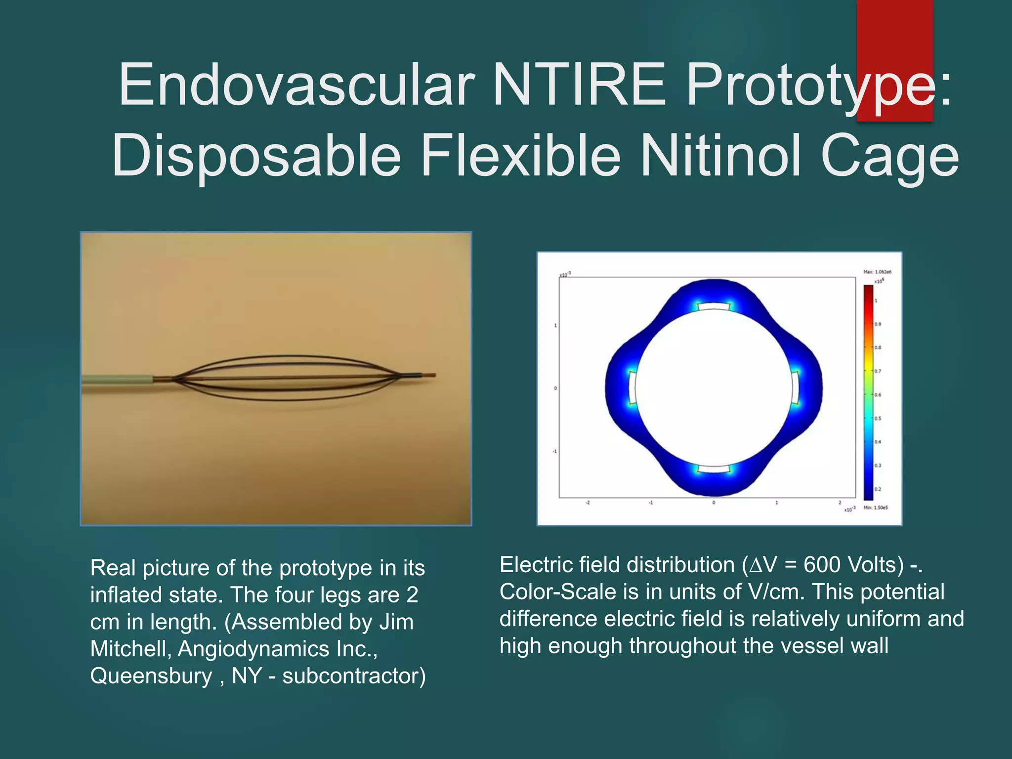 Endovascular NTIRE Prototype:
Disposable Flexible Nitinol Cage
Real picture of the prototype in its
inflated state. The four legs are 2
cm in length. (Assembled by Jim
Mitchell, Angiodynamics Inc.,
Queensbury , NY - subcontractor)
Electric field distribution (∆V = 600 Volts) -.
Color-Scale is in units of V/cm. This potential
difference electric field is relatively uniform and
high enough throughout the vessel wall
 